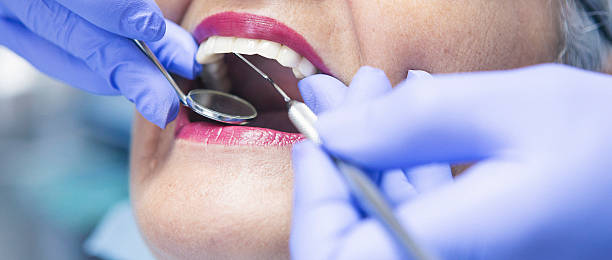 Best Broken or Chipped Tooth Repair in Abram, TX